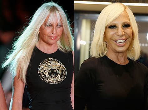 ritocchi donatella versace|donatella versace.